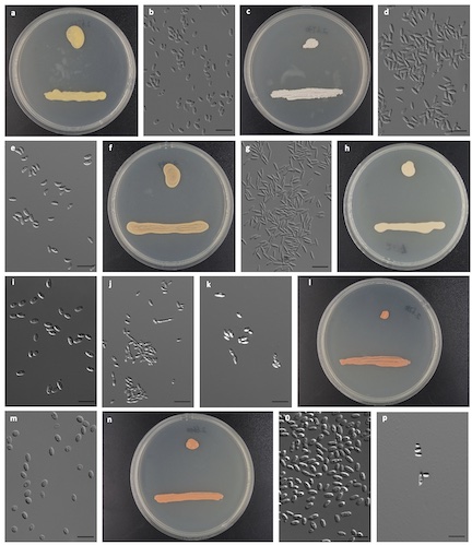 The hidden taxonomic novelty of anamorphic basidiomycetous yeasts in the phyllosphere and tidal flats in China