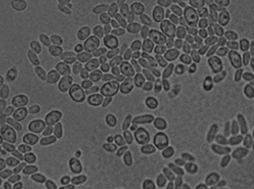 A Cluster of i Diutina catenulata i Funguria in Patients with Coronavirus Disease 2019 COVID-19 Hospitalized in a Tertiary Reference Hospital from Rio de Janeiro, Brazil