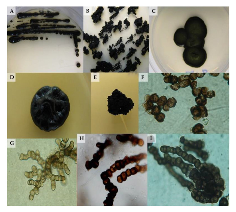 Shed Light in the DaRk LineagES of the Fungal Tree of Life-STRES.
