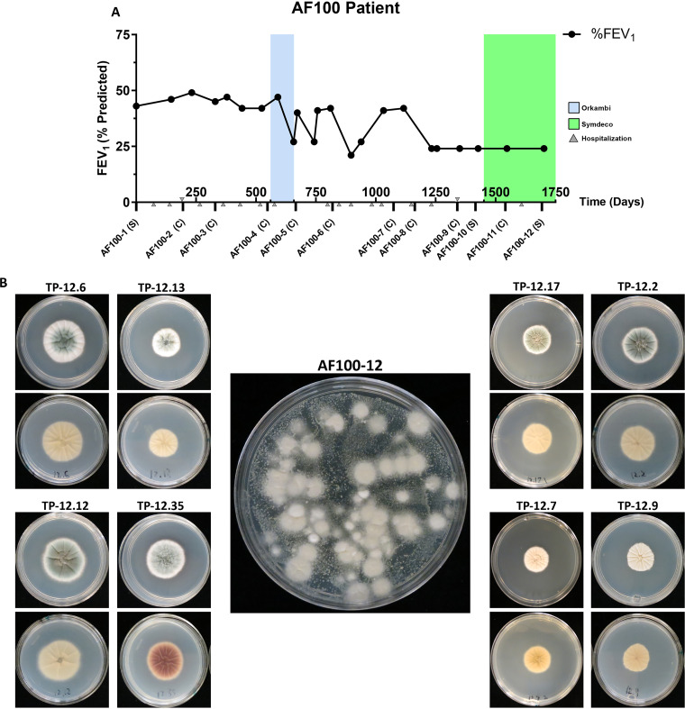 Aspergillus fumigatus In-Host HOG Pathway Mutation for Cystic Fibrosis Lung Microenvironment Persistence