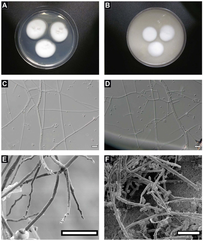 Genomic Characterization of i Parengyodontium torokii i sp. nov., a Biofilm-Forming Fungus Isolated from Mars 2020 Assembly Facility