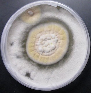 A Novel i Sarocladium spinificis i Strain Suppresses i Coccidioides posadasii i Growth Morphological and Genetic Perspectives