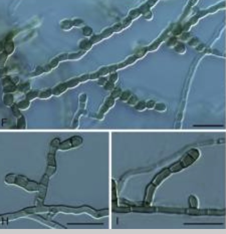 Description of new micro-colonial fungi species